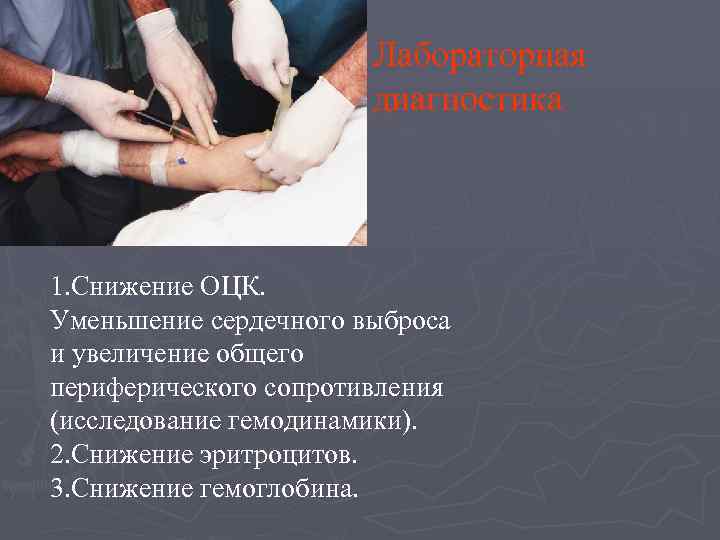 Лабораторная диагностика 1. Снижение ОЦК. Уменьшение сердечного выброса и увеличение общего периферического сопротивления (исследование