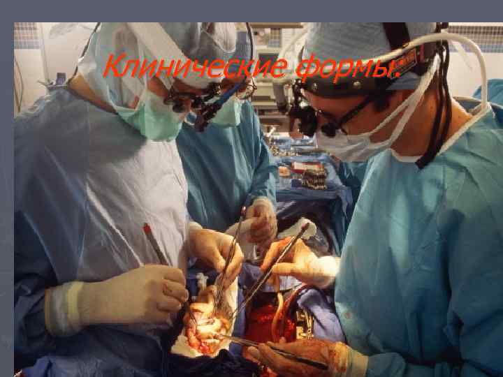 Клинические формы: 