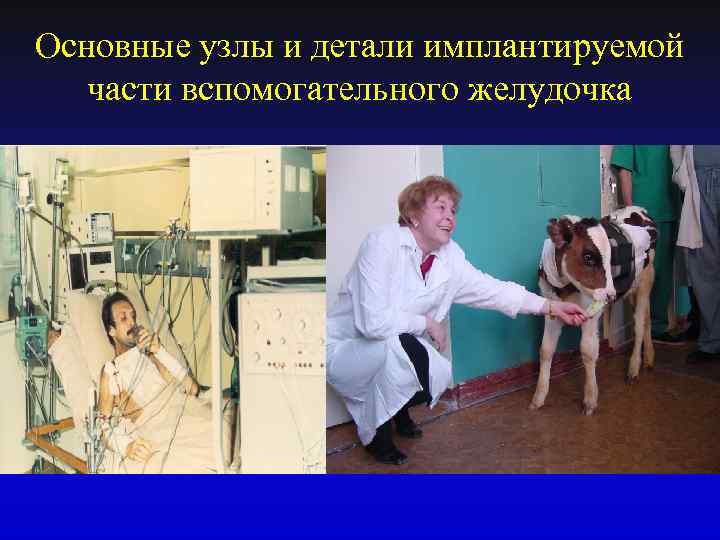 Основные узлы и детали имплантируемой части вспомогательного желудочка 