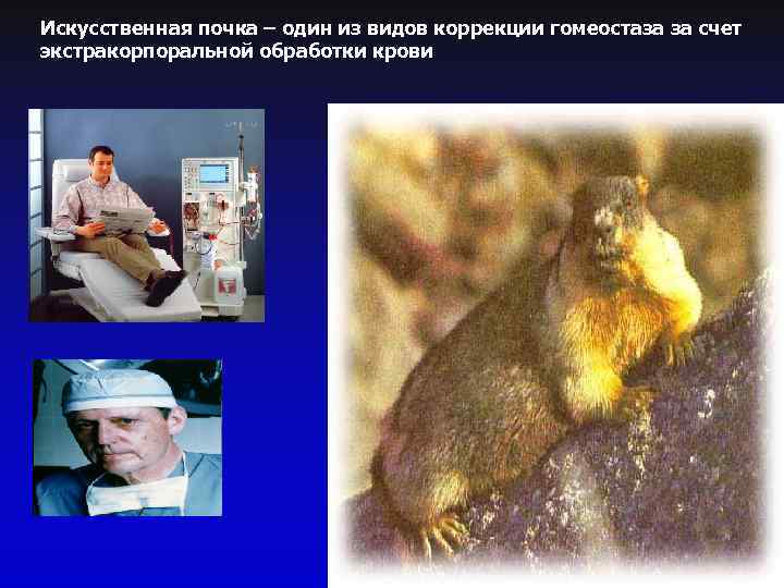 Искусственная почка – один из видов коррекции гомеостаза за счет экстракорпоральной обработки крови 
