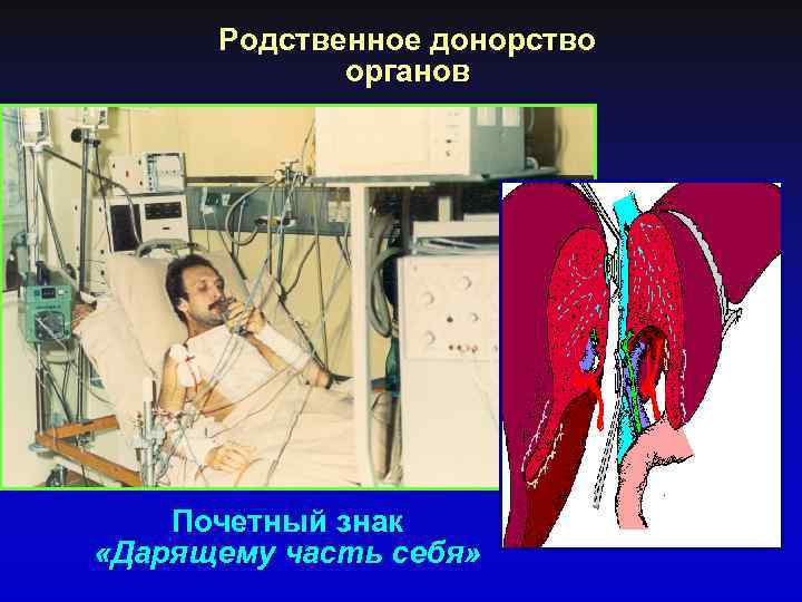 Родственное донорство органов Почетный знак «Дарящему часть себя» 