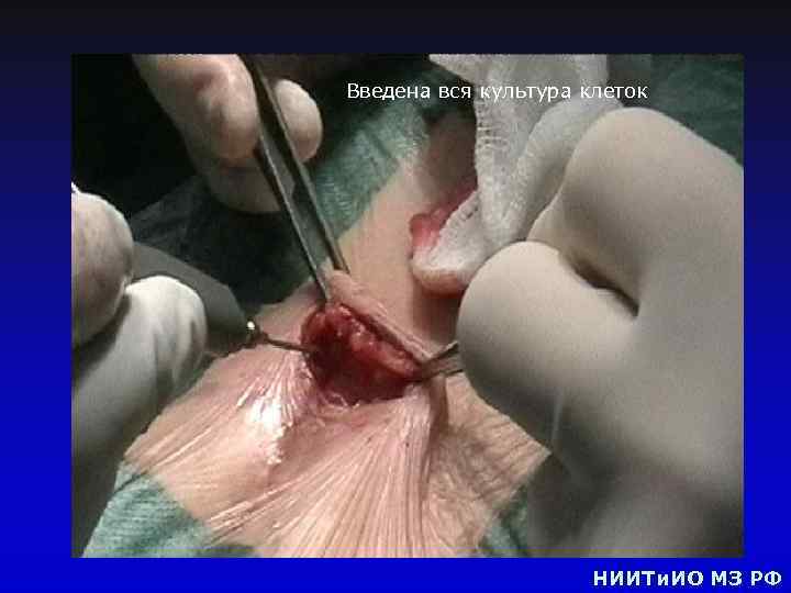Введена вся культура клеток НИИТи. ИО МЗ РФ 