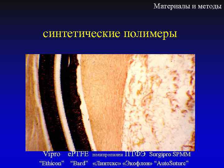 Материалы и методы синтетические полимеры Vipro e. PTFE полипропилен ПТФЭ Surgipro SPMM “Ethicon” “Bard”