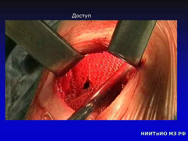 Доступ НИИТи. ИО МЗ РФ 