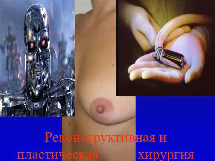 Реконструктивная и пластическая хирургия 