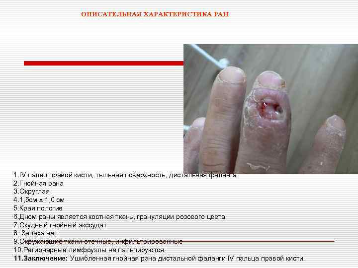 ОПИСАТЕЛЬНАЯ ХАРАКТЕРИСТИКА РАН 1. IV палец правой кисти, тыльная поверхность, дистальная фаланга 2. Гнойная