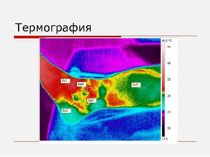 Термография 