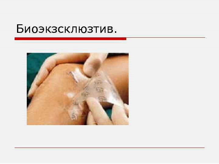 Биоэкзсклюзтив. 