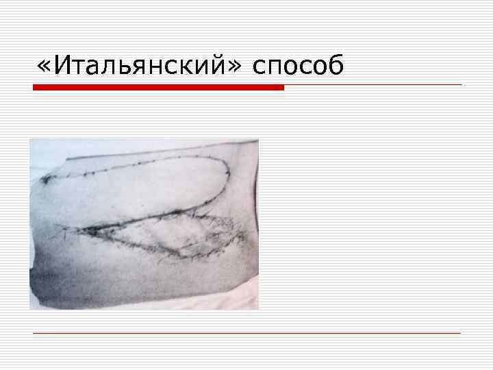  «Итальянский» способ 