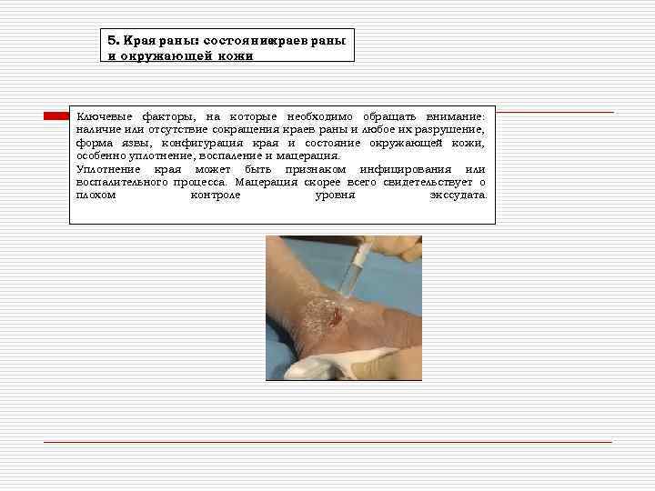 5. Края раны: состояние краев раны и окружающей кожи Ключевые факторы, на которые необходимо