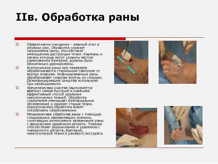 IIв. Обработка раны o o Эффективное очищение – важный этап в лечении ран. Обработка