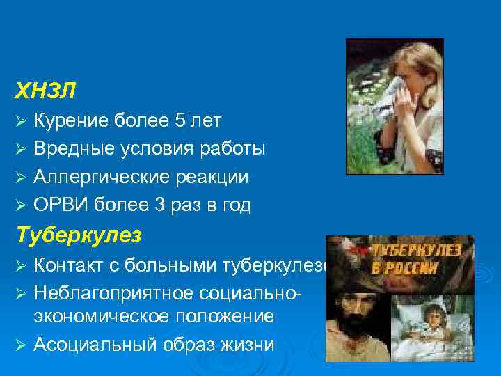 ХНЗЛ Курение более 5 лет Ø Вредные условия работы Ø Аллергические реакции Ø ОРВИ
