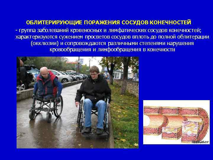 ОБЛИТЕРИРУЮЩИЕ ПОРАЖЕНИЯ СОСУДОВ КОНЕЧНОСТЕЙ группа заболеваний кровеносных и лимфатических сосудов конечностей; характеризуются сужением