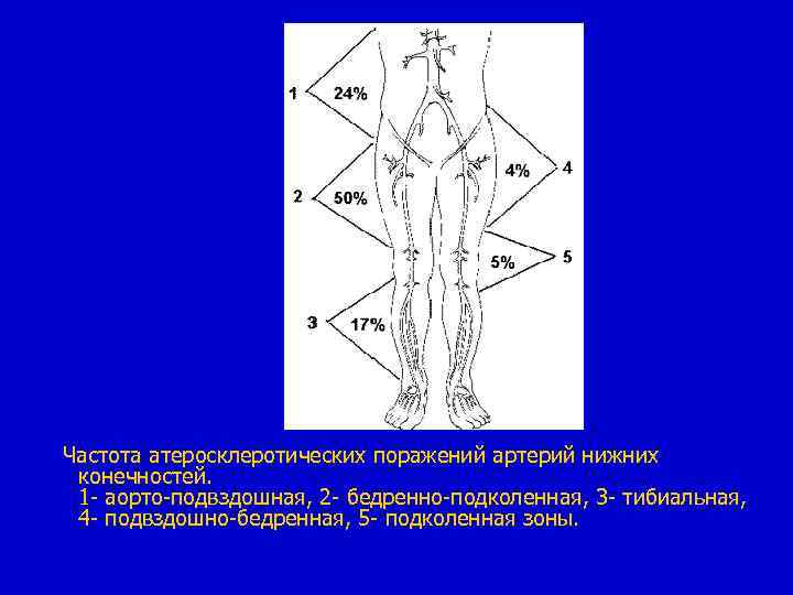 Острая артериальная непроходимость нижних конечностей презентация