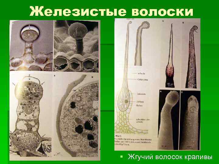 Железистые волоски § Жгучий волосок крапивы 