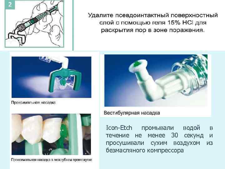 Зубные инструкция по применению. Айкон состав стоматология. Система icon в стоматологии. Icon стоматология инструкция. Айкон в стоматологии инструкция.