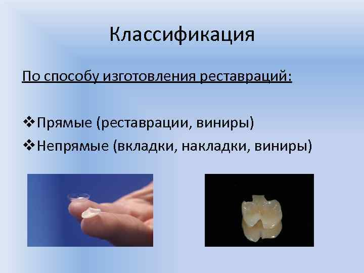 Классификация По способу изготовления реставраций: v. Прямые (реставрации, виниры) v. Непрямые (вкладки, накладки, виниры)