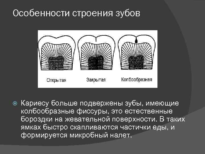 Особенности строения зубов Кариесу больше подвержены зубы, имеющие колбообразные фиссуры, это естественные бороздки на