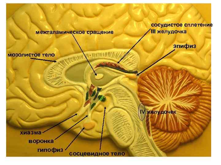 межталамическое сращение сосудистое сплетение III желудочка эпифиз мозолистое тело IV желудочек хиазма воронка гипофиз