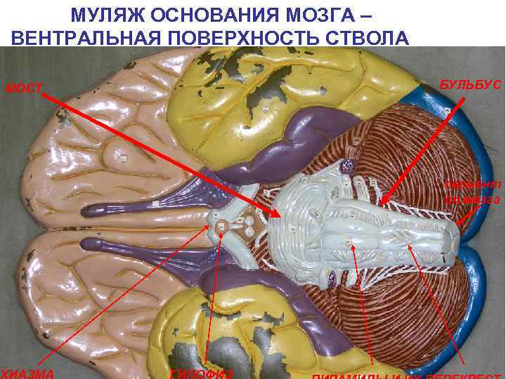 МУЛЯЖ ОСНОВАНИЯ МОЗГА – ВЕНТРАЛЬНАЯ ПОВЕРХНОСТЬ СТВОЛА БУЛЬБУС МОСТ ХИАЗМА сегмент сп. мозга ГИПОФИЗ