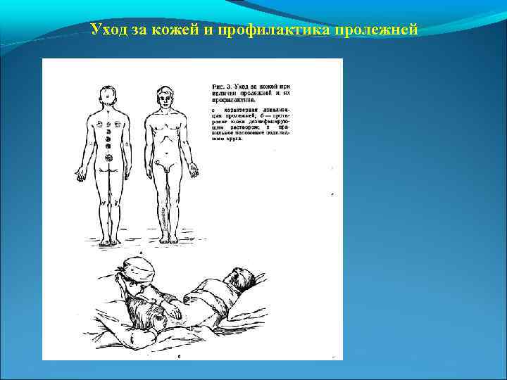 Уход за кожей и профилактика пролежней 