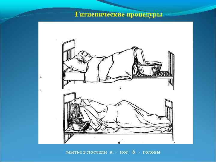 Гигиенические процедуры мытье в постели а. - ног, б. - головы 