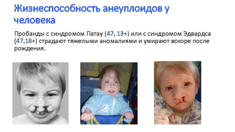 Жизнеспособность анеуплоидов у человека Пробанды с синдромом Патау (47, 13+) или с синдромом Эдвардса