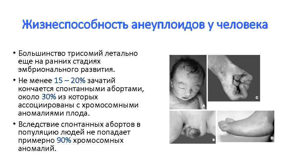 Жизнеспособность анеуплоидов у человека • Большинство трисомий летально еще на ранних стадиях эмбрионального развития.