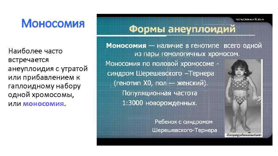 Моносомия Наиболее часто встречается анеуплоидия с утратой или прибавлением к гаплоидному набору одной хромосомы,