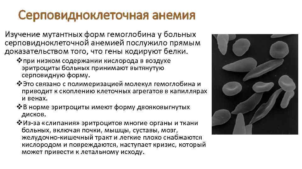 Серповидноклеточная анемия Изучение мутантных форм гемоглобина у больных серповидноклеточной анемией послужило прямым доказательством того,