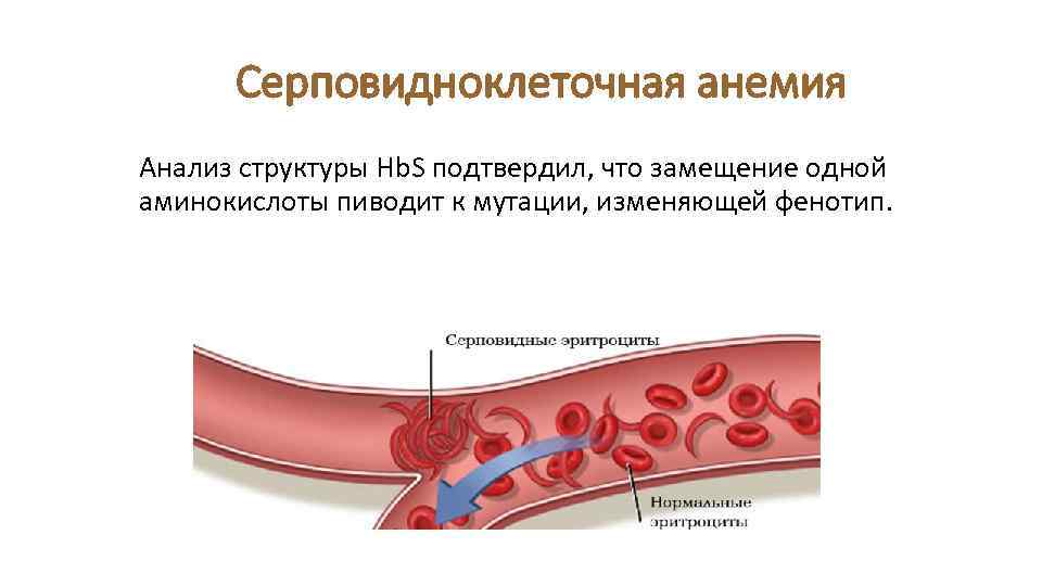 Серповидноклеточная анемия Анализ структуры Hb. S подтвердил, что замещение одной аминокислоты пиводит к мутации,
