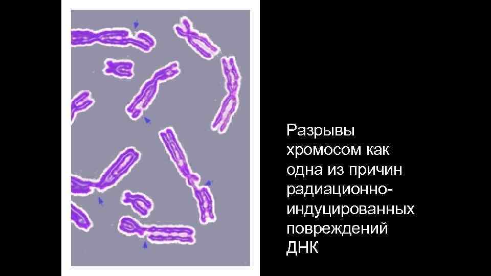 Разрывы хромосом как одна из причин радиационноиндуцированных повреждений ДНК 
