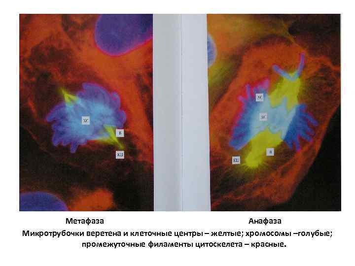  Метафаза Анафаза Микротрубочки веретена и клеточные центры – желтые; хромосомы –голубые; промежуточные филаменты