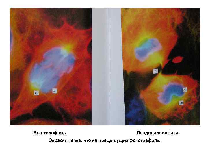  Ана-телофаза. Поздняя телофаза. Окраски те же, что на предыдущих фотографиях. 