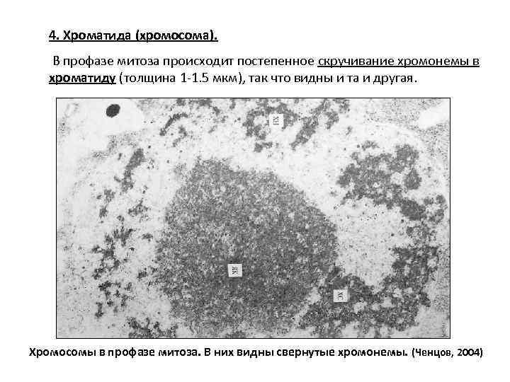 4. Хроматида (хромосома). В профазе митоза происходит постепенное скручивание хромонемы в хроматиду (толщина 1