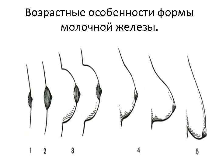 Возрастные особенности формы молочной железы. 