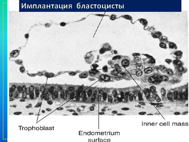 Имплантация бластоцисты 