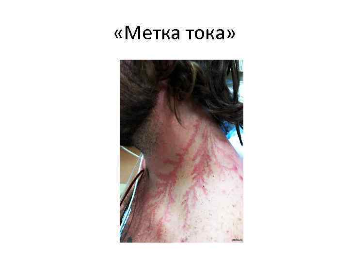  «Метка тока» 