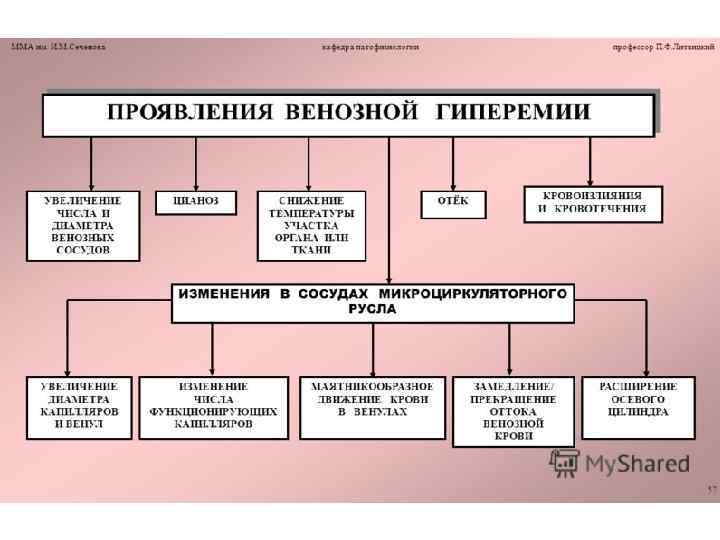 Признаки венозной гиперемии рисунок