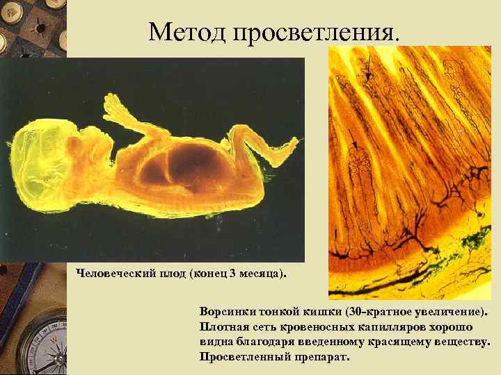 Метод просветления. Человеческий плод (конец 3 месяца). Ворсинки тонкой кишки (30 -кратное увеличение). Плотная