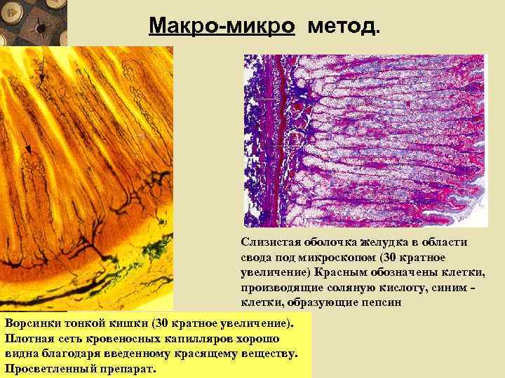 Макро-микро метод. Слизистая оболочка желудка в области свода под микроскопом (30 кратное увеличение) Красным