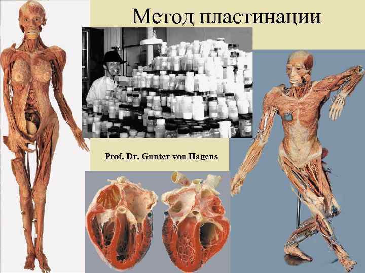 Метод пластинации Prof. Dr. Gunter von Hagens 