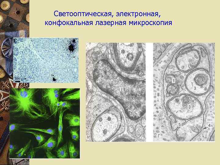 Светооптическая, электронная, конфокальная лазерная микроскопия 