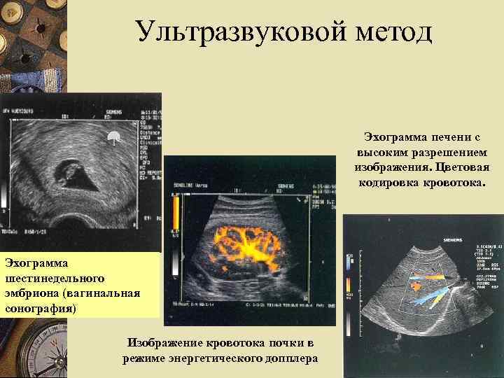 Ультразвуковой метод Эхограмма печени с высоким разрешением изображения. Цветовая кодировка кровотока. Эхограмма шестинедельного эмбриона