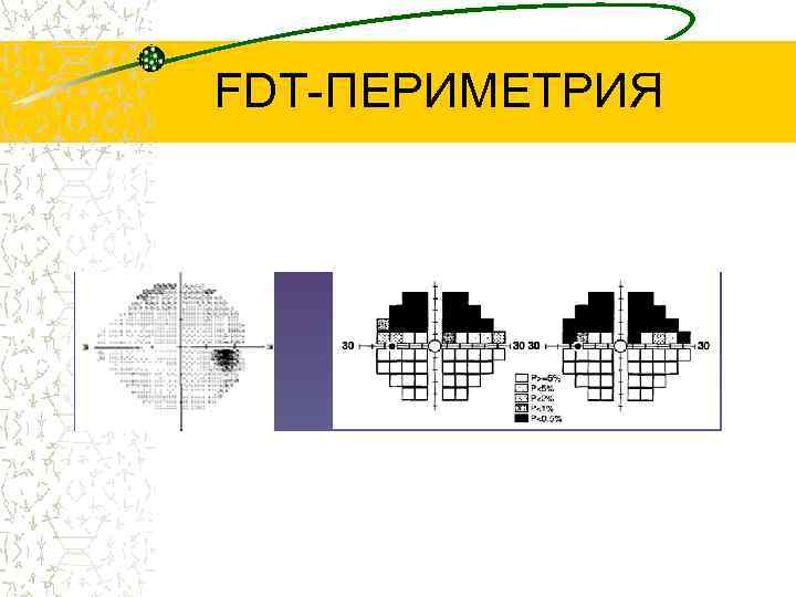 FDT-ПЕРИМЕТРИЯ 