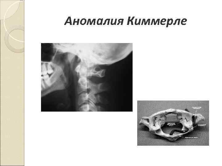 Аномалия киммерли картинка