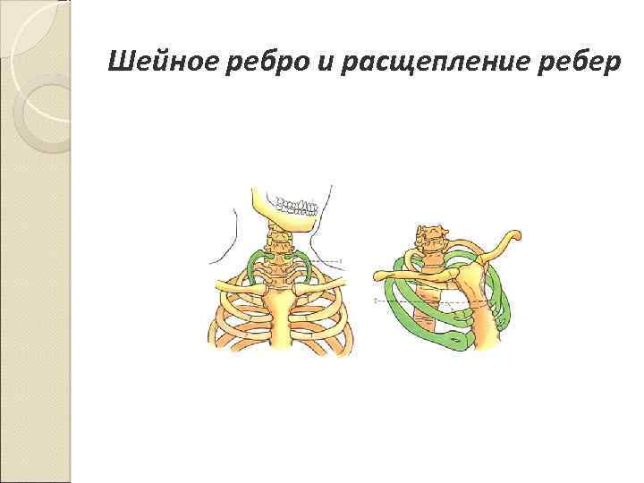 Презентация на тему расщепление позвоночника