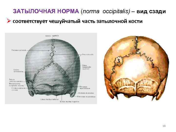 Череп задняя часть. Швы черепа затылочная кость. Строение затылочной кости черепа человека.