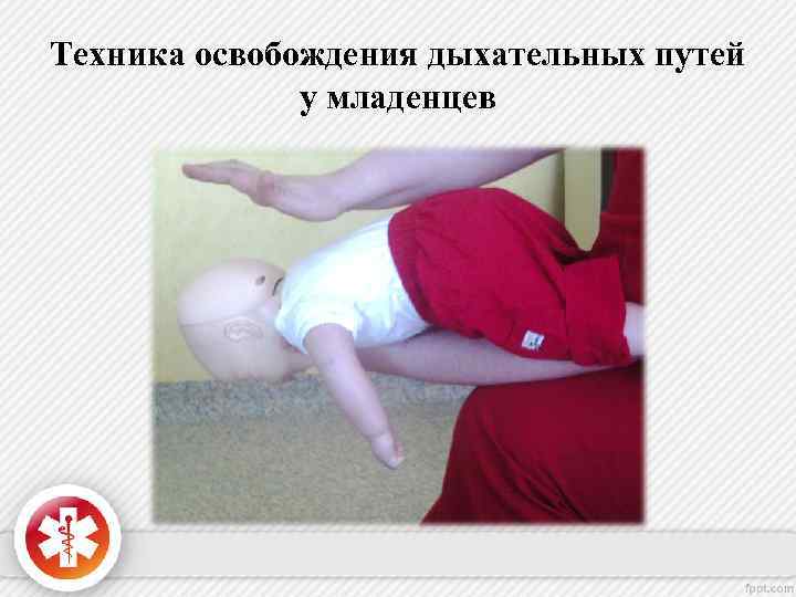 Техника освобождения дыхательных путей у младенцев 