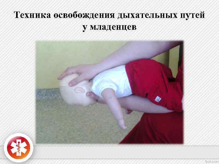 Техника освобождения дыхательных путей у младенцев 